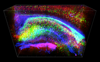 Illustration for article titled Scientists can now turn brains invisible